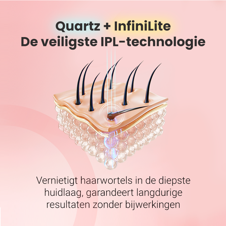 IPL fotoepilator Hilda